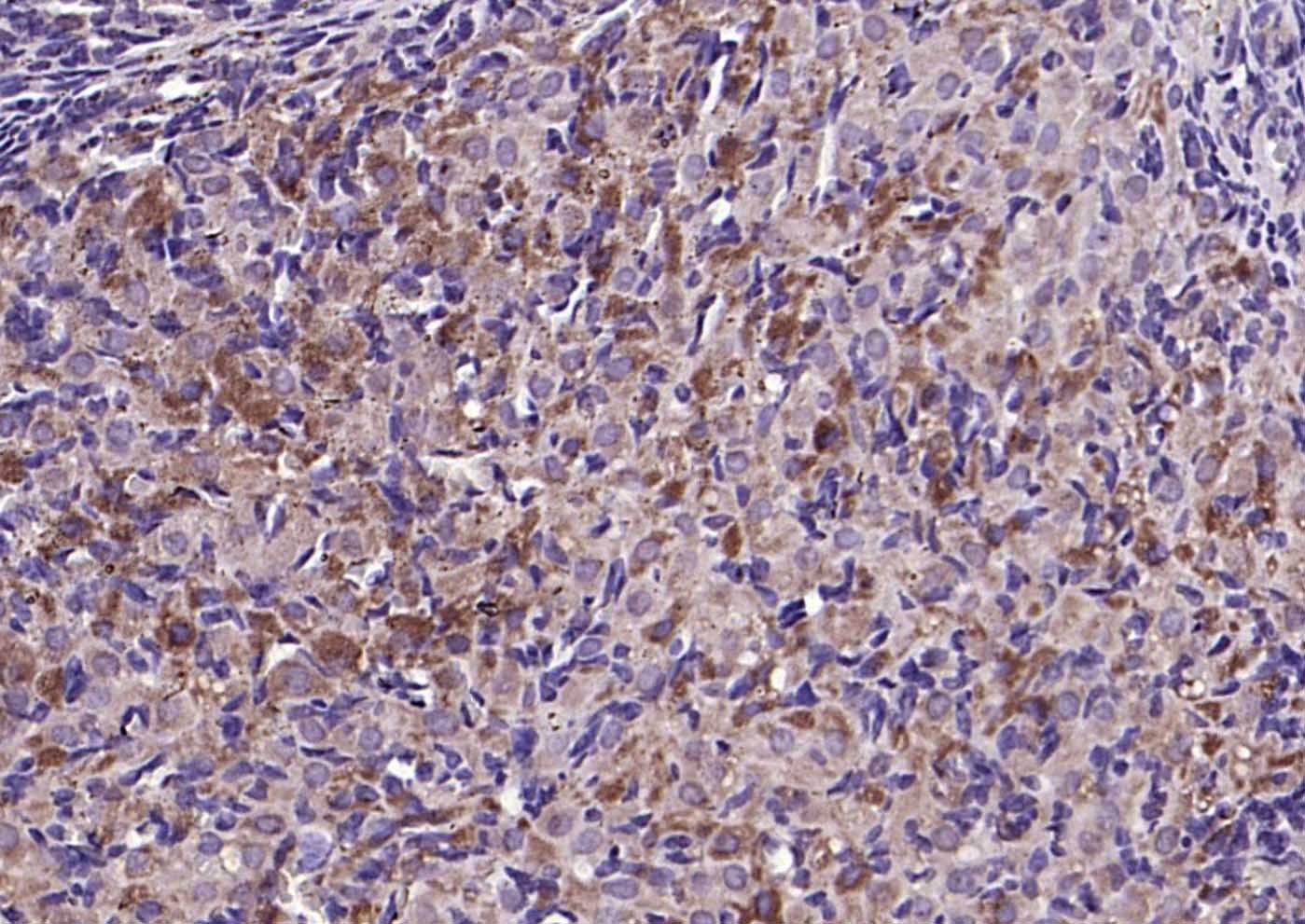 Anti-CILP Polyclonal Antibody