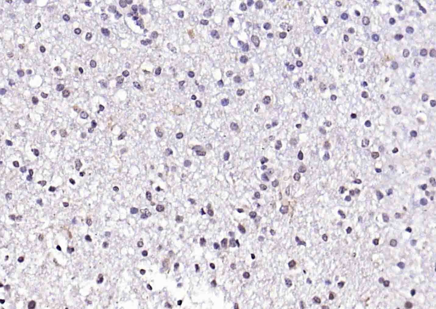 Anti-CREB5 Polyclonal Antibody