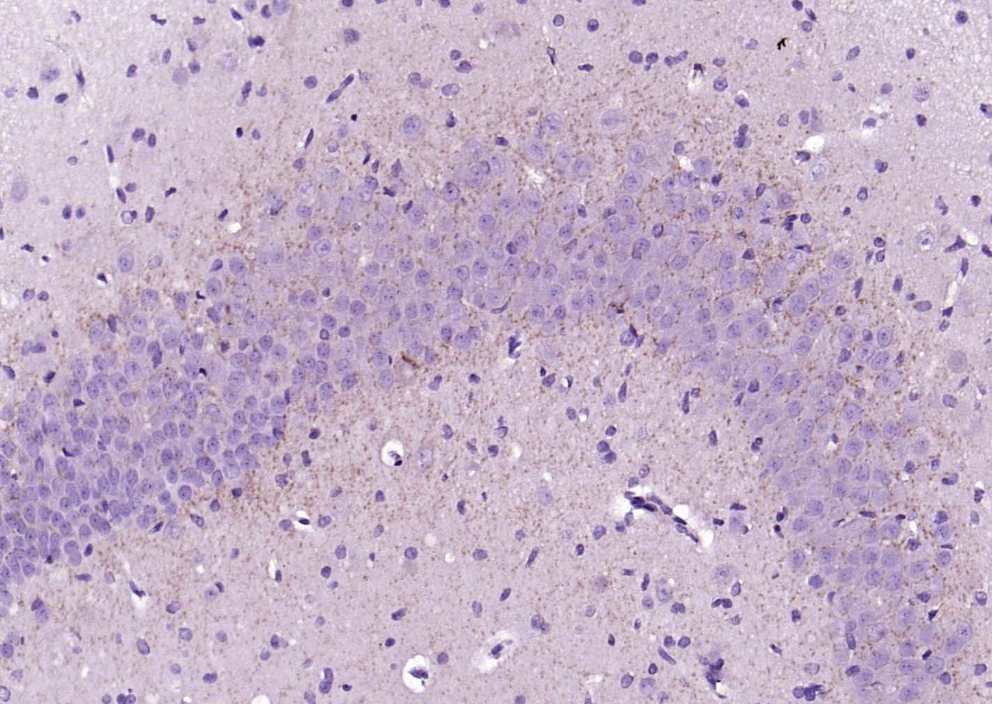 Anti-CNR1 Polyclonal Antibody