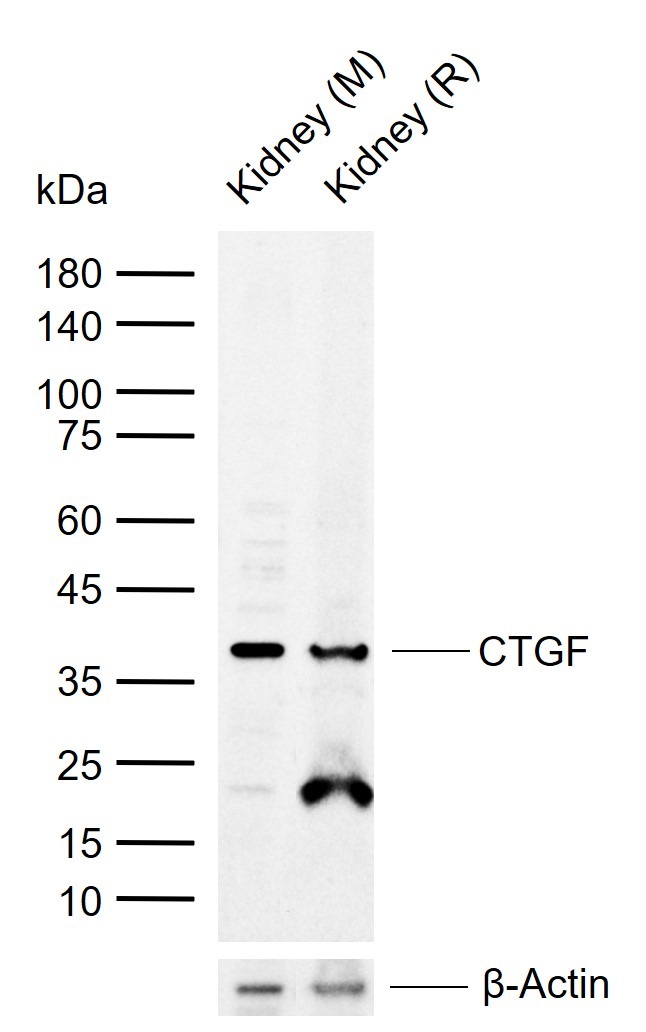 Anti-CTGF/CCN2 Polyclonal Antibody