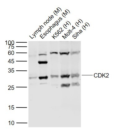 Anti-CDK2 Polyclonal Antibody 2