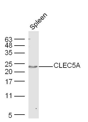 Anti-CLEC5A Polyclonal Antibody