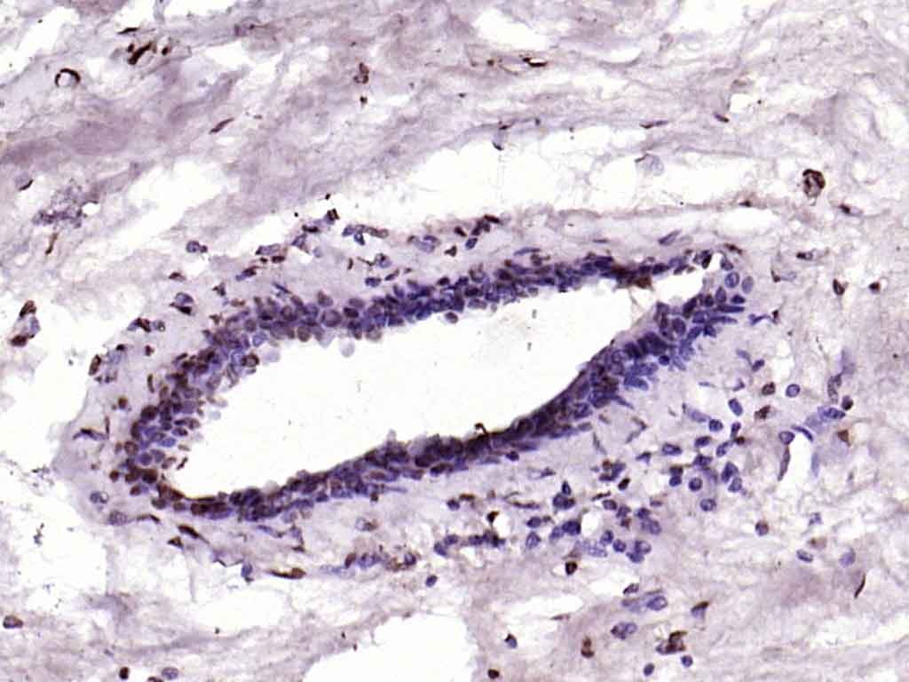 Anti-CDKN1A Polyclonal Antibody