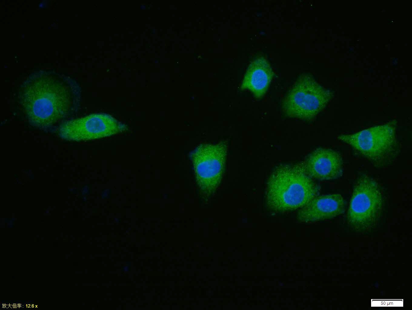 Anti-CDKN1A Polyclonal Antibody 2