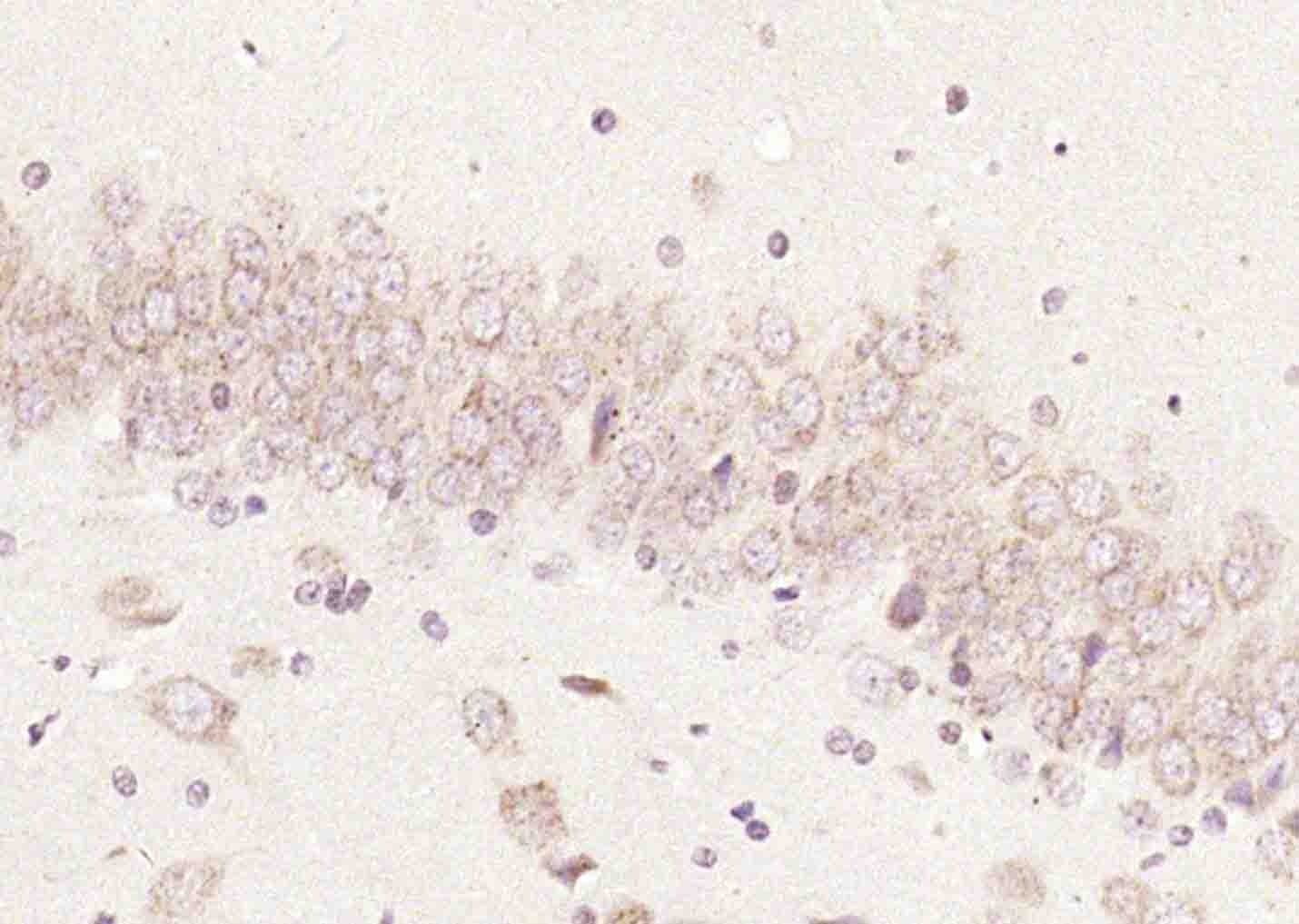 Anti-CDK4 Polyclonal Antibody