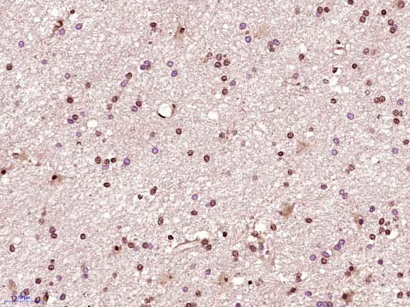 Anti-CDK6 Polyclonal Antibody