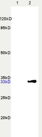 Anti-CDK4 Polyclonal Antibody