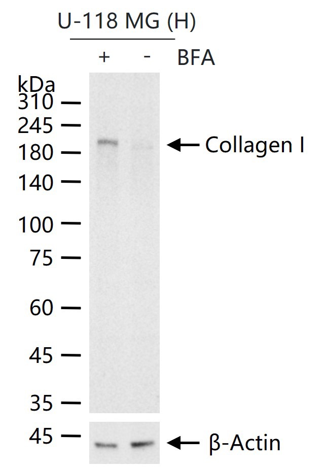 Anti-Collagen I/COL1A1 Polyclonal Antibody 2
