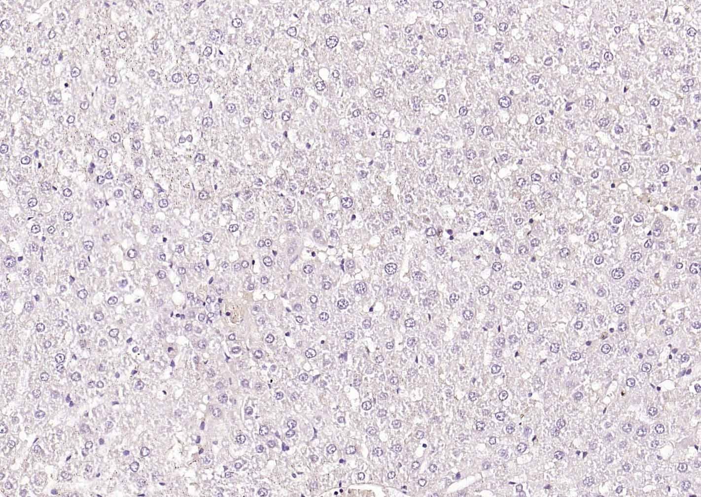 Anti-CNR1 Polyclonal Antibody