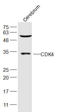 Anti-CDK4 Polyclonal Antibody