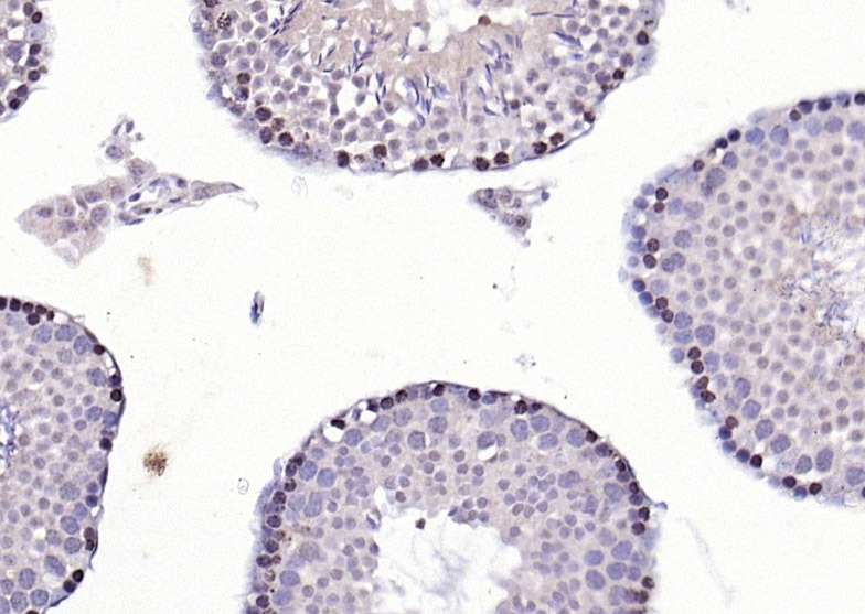 Anti-CDK6 Polyclonal Antibody