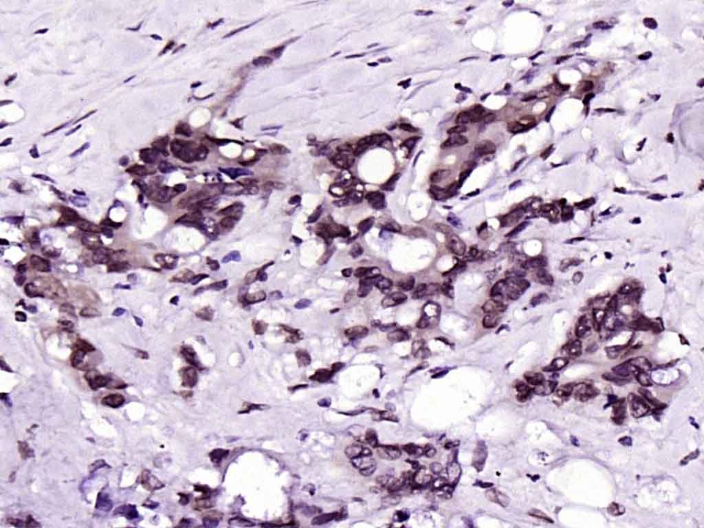 Anti-CDK4 Antibody (6D570)