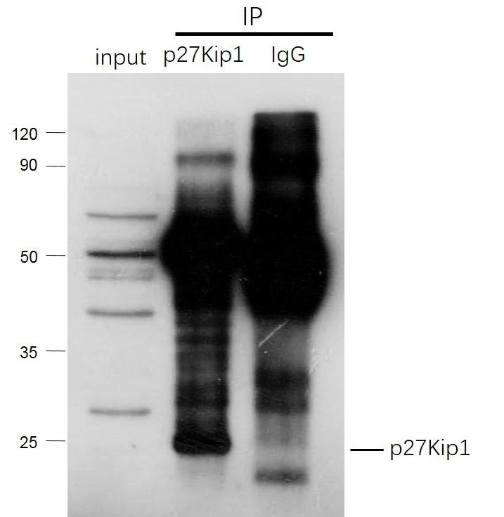Anti-CDKN1B Polyclonal Antibody