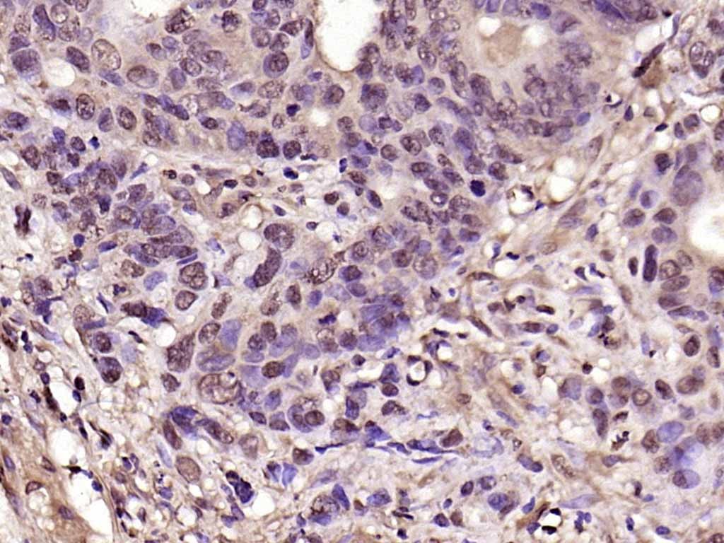 Anti-CDK6 Polyclonal Antibody