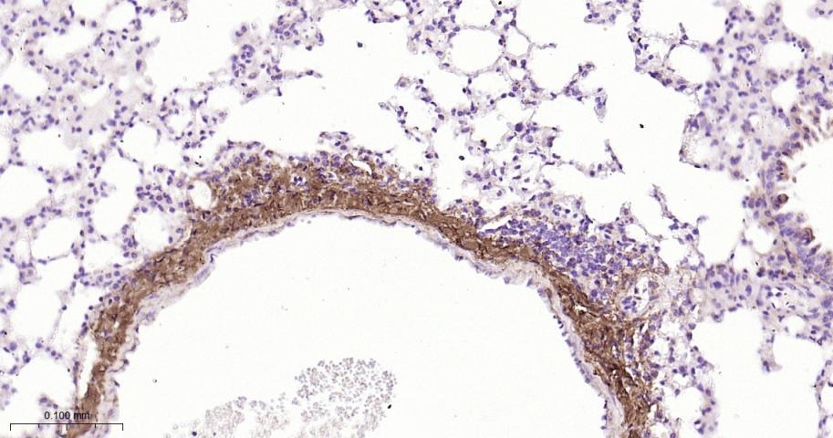 Anti-Collagen I/COL1A1 Polyclonal Antibody 2