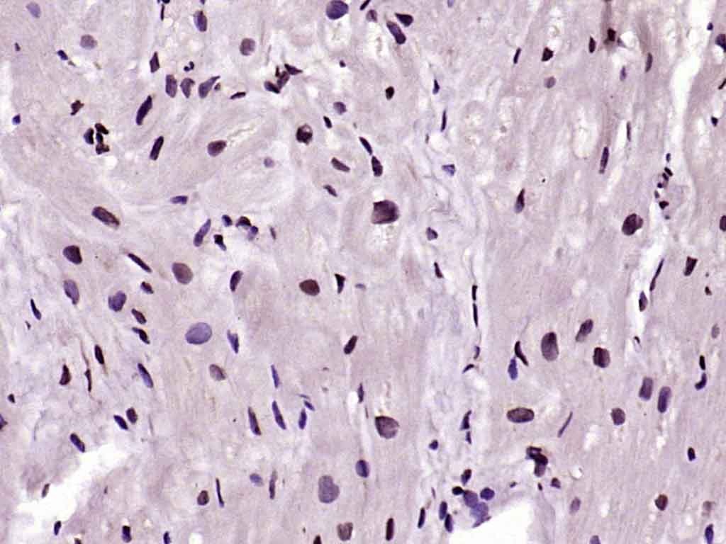 Anti-CDK4 Antibody (6D570)