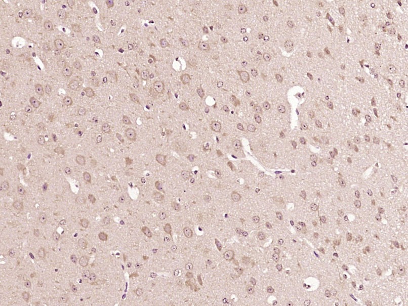 Anti-CSPG4 Polyclonal Antibody