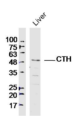 Anti-CTH Polyclonal Antibody
