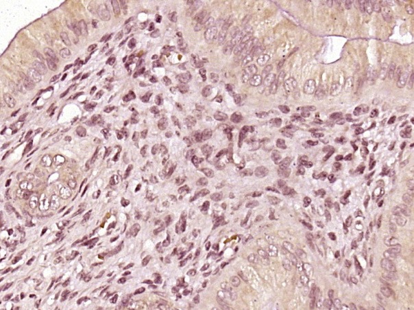 Anti-CDKN1A Polyclonal Antibody 2