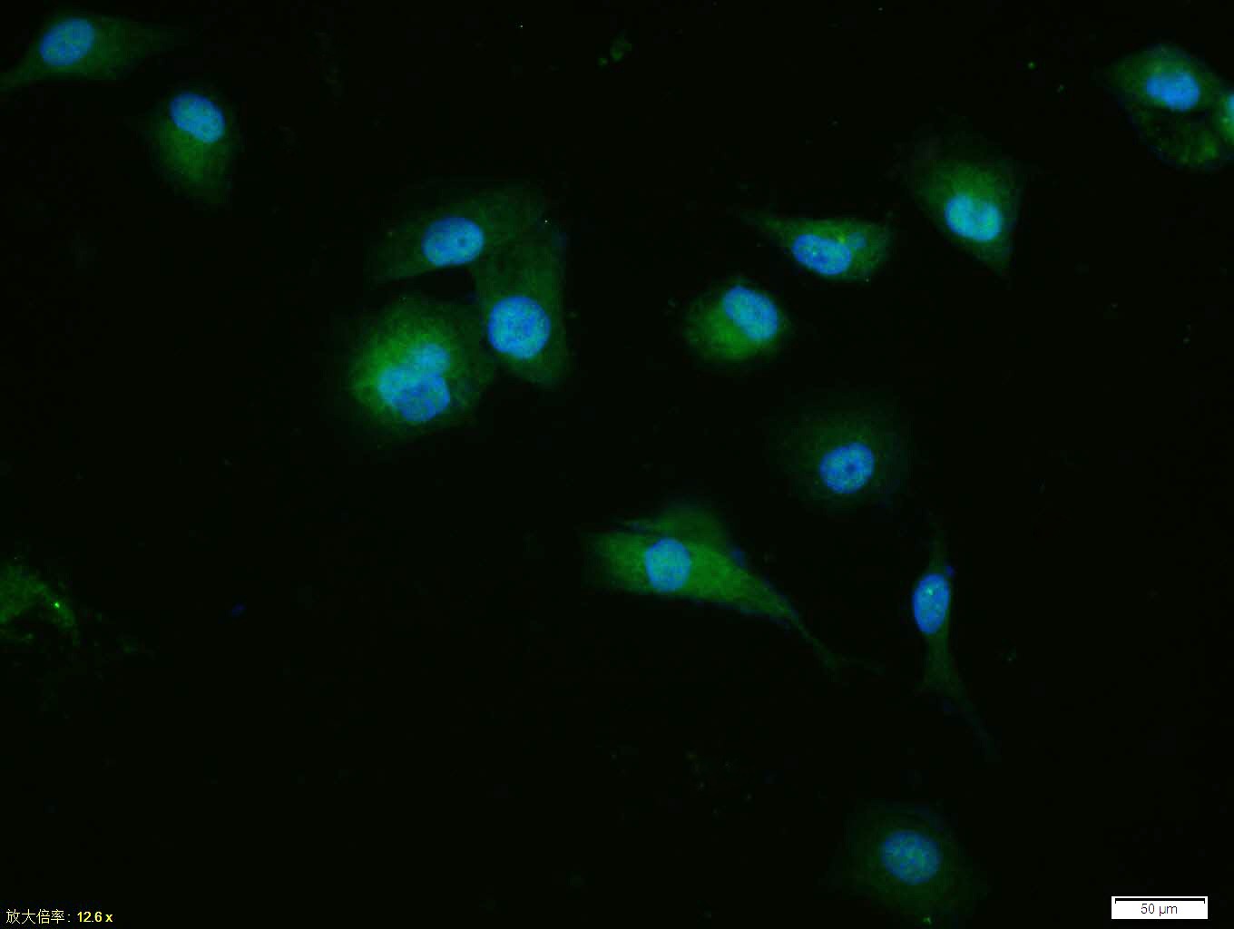 Anti-CDKN1A Polyclonal Antibody