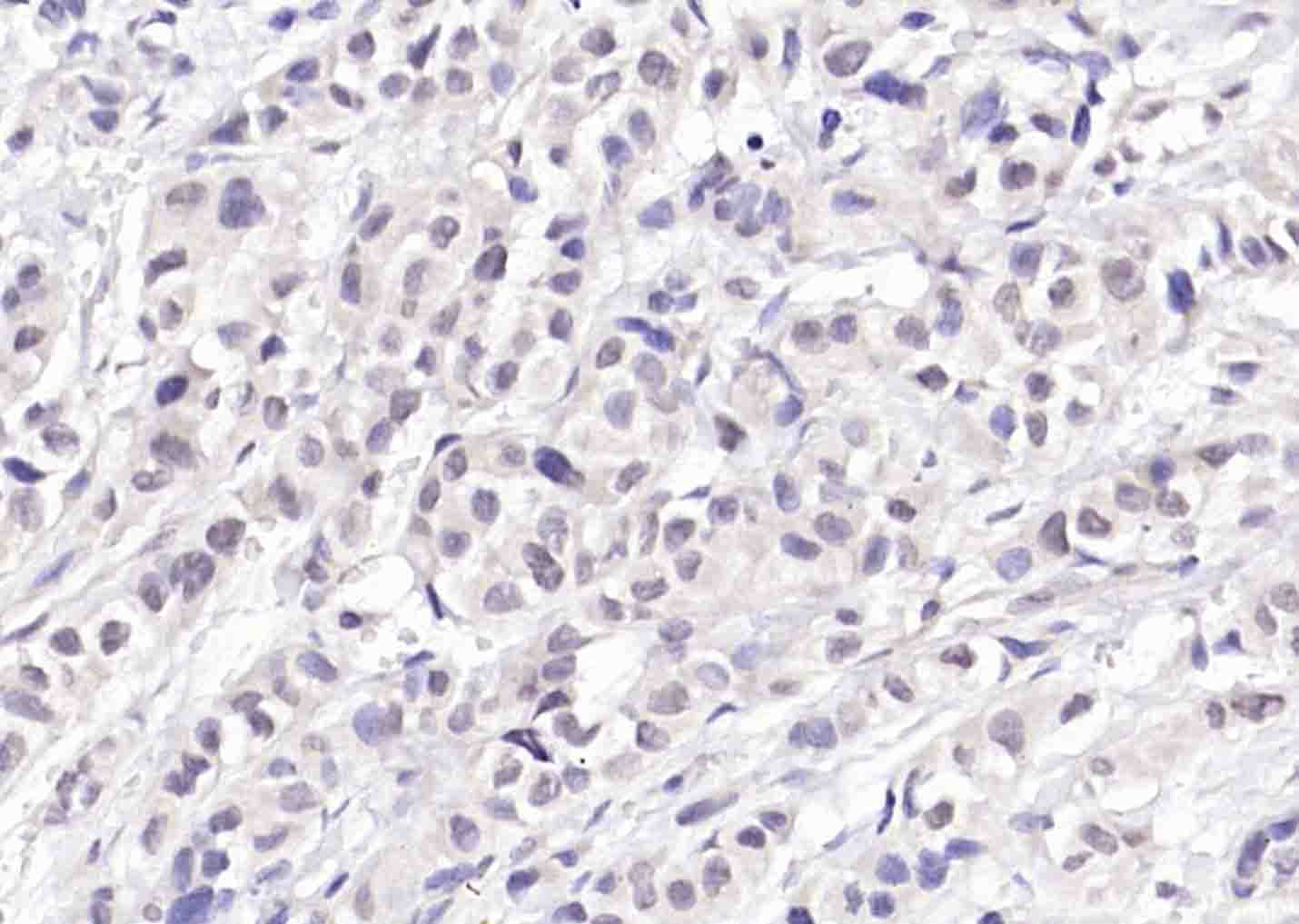 Anti-CDKN2A Polyclonal Antibody 2