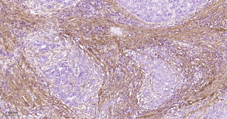 Anti-Collagen I/COL1A1 Polyclonal Antibody 2