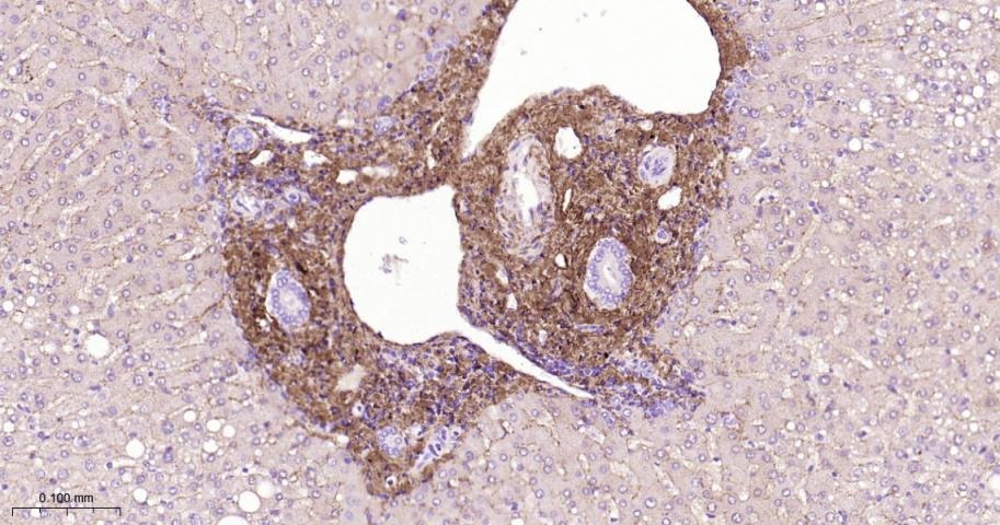 Anti-Collagen I/COL1A1 Polyclonal Antibody 2
