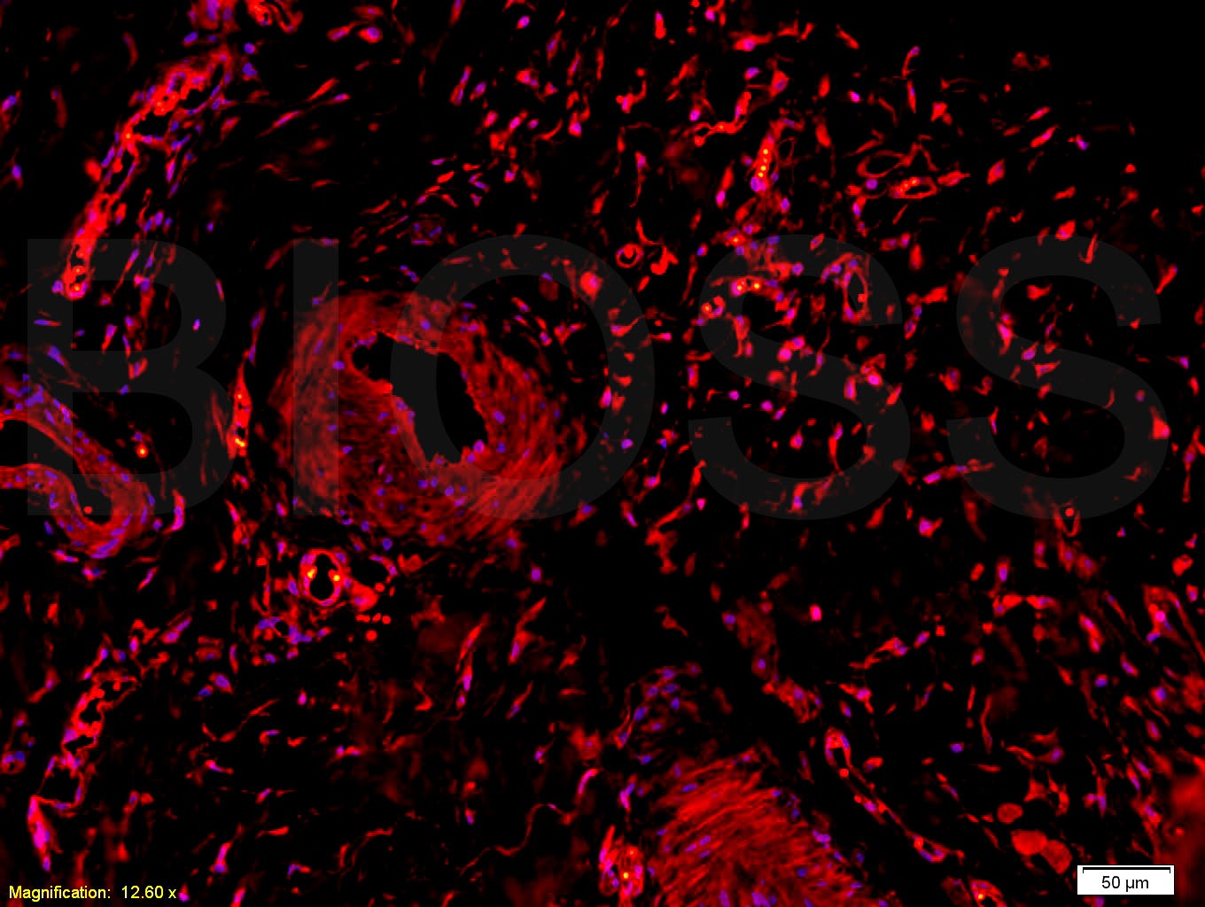 Anti-Collagen II/COL2A1 Polyclonal Antibody