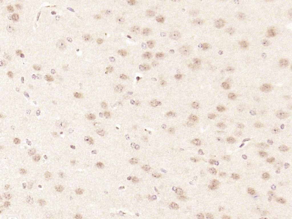 Anti-CDKN2A Polyclonal Antibody 2