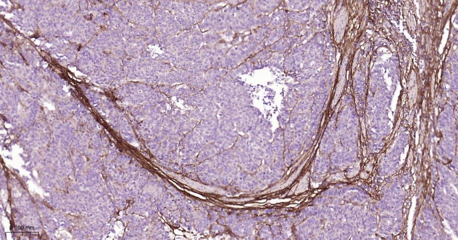 Anti-Collagen I/COL1A1 Polyclonal Antibody 2