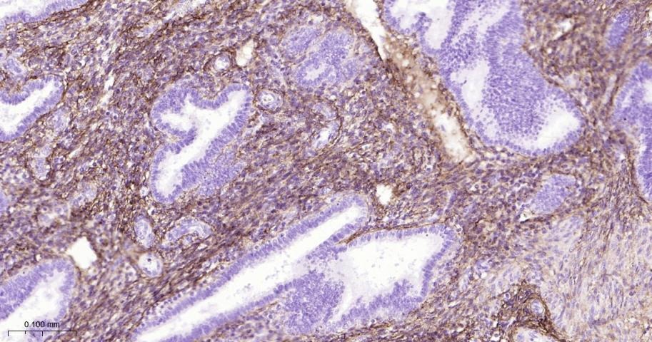 Anti-Collagen I/COL1A1 Polyclonal Antibody 2