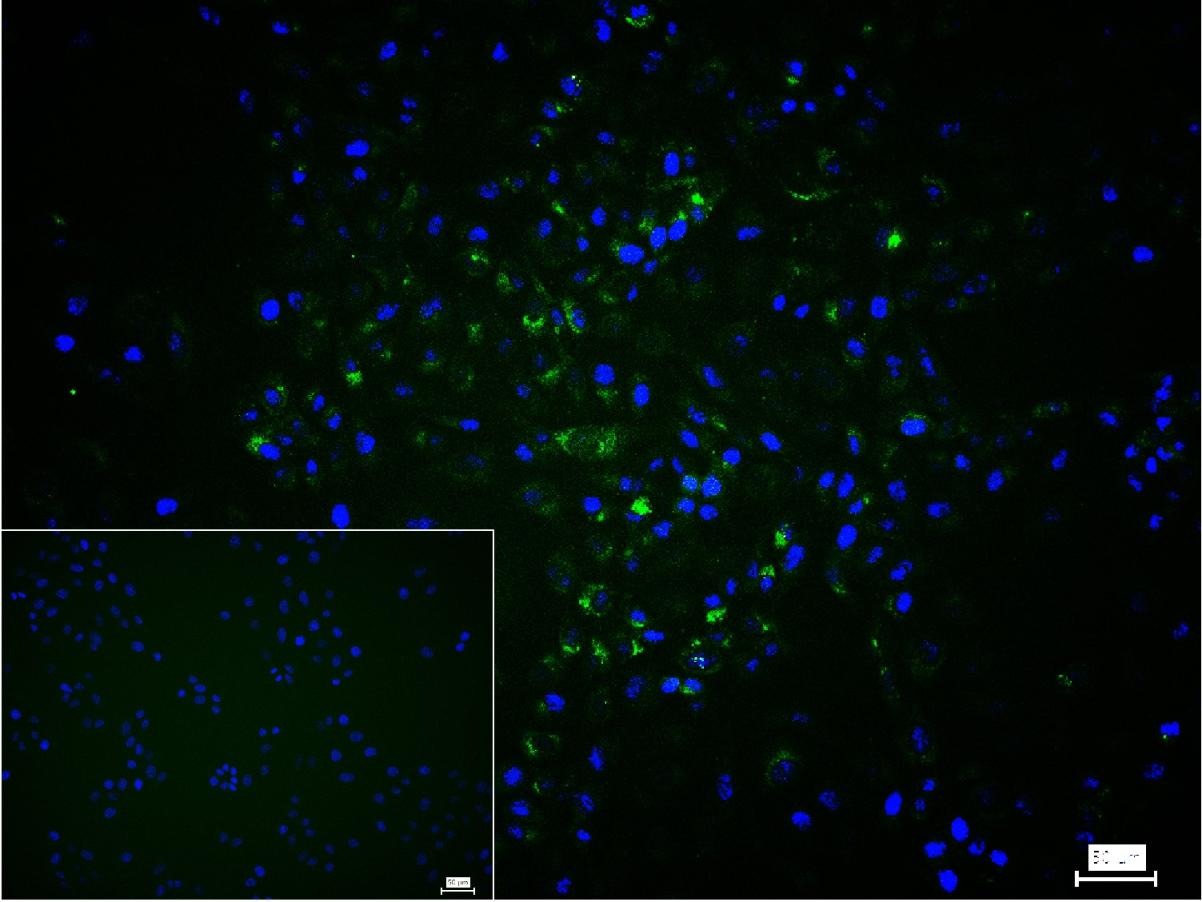 Anti-Collagen I/COL1A1 Polyclonal Antibody 2
