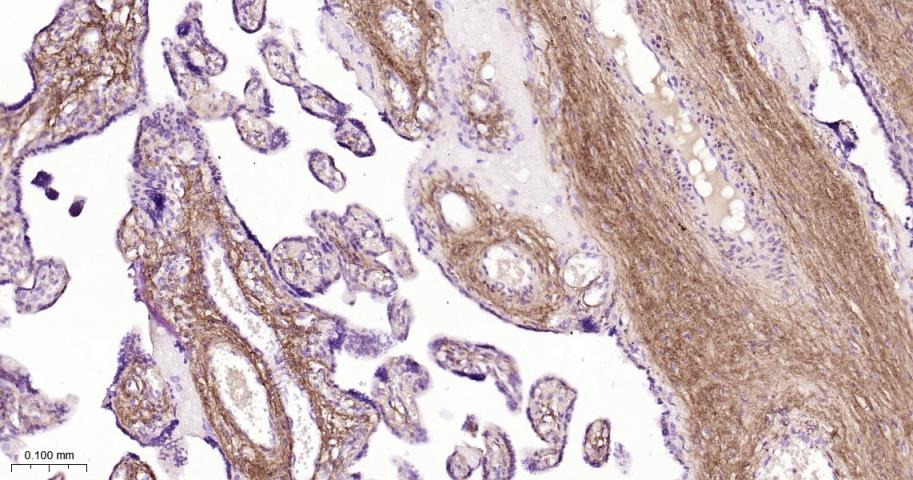 Anti-Collagen I/COL1A1 Polyclonal Antibody 2