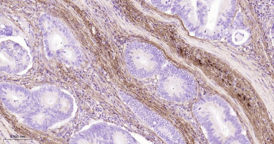 Anti-Collagen I/COL1A1 Polyclonal Antibody 2