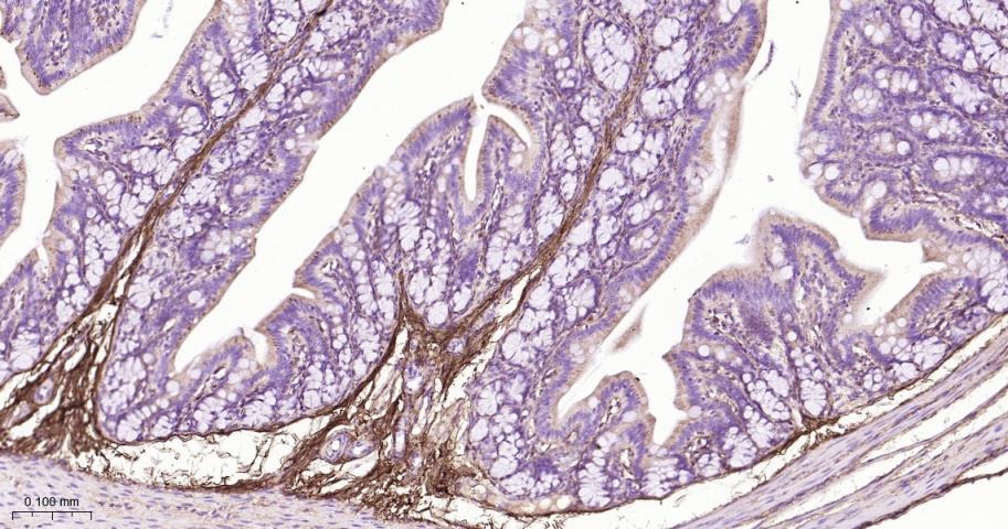 Anti-Collagen I/COL1A1 Polyclonal Antibody 2