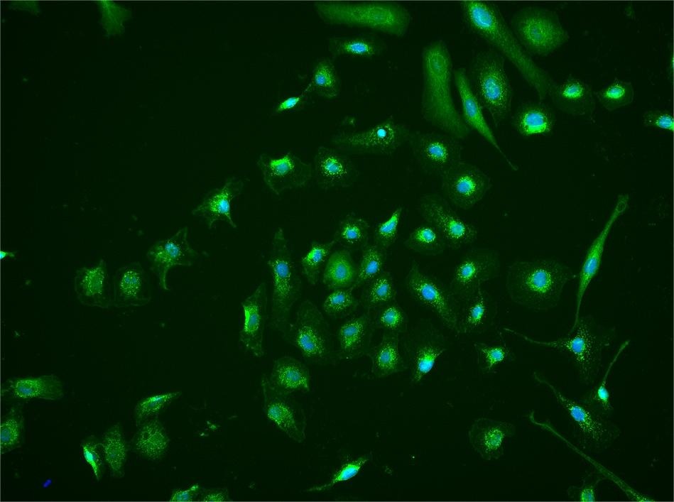 Anti-HIF-3 alpha Polyclonal Antibody