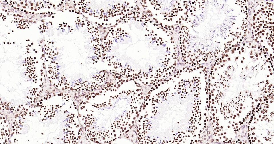 Histone H3 Nuclear Loading Control Antibody (6Z247)