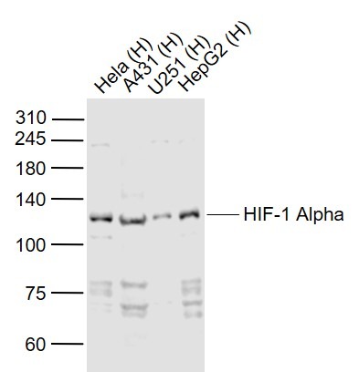 Anti-HIF-1 alpha Polyclonal Antibody 3