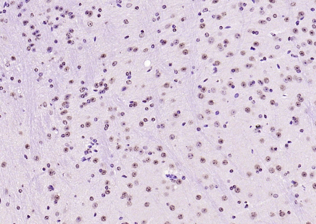 Anti-SOX9 Polyclonal Antibody 2