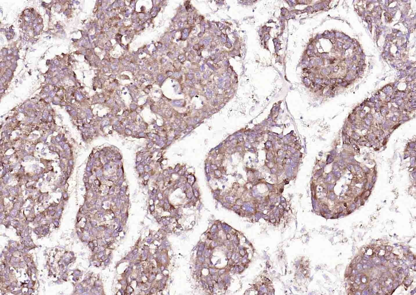 Anti-SLC39A14 Polyclonal Antibody