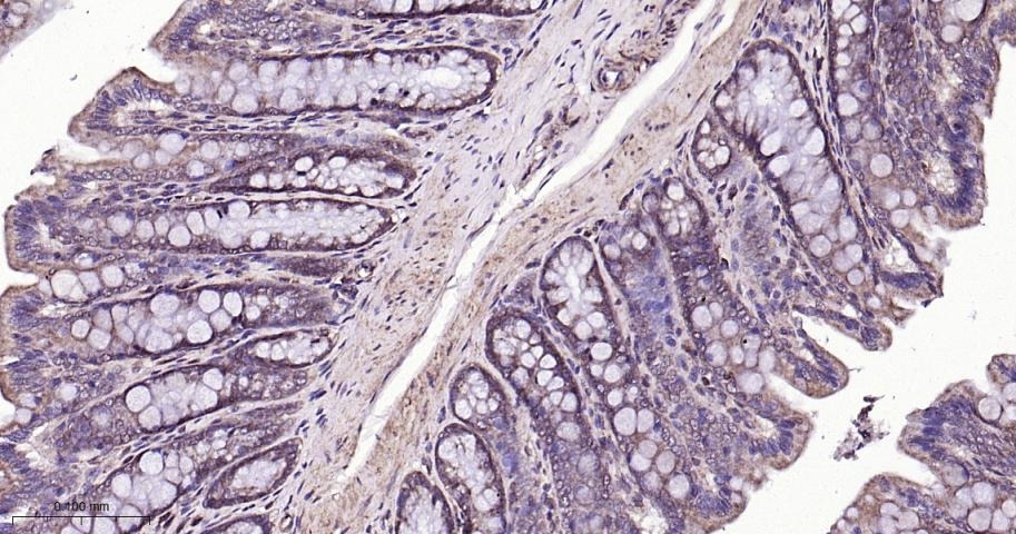 Anti-SIRT3 Polyclonal Antibody 2