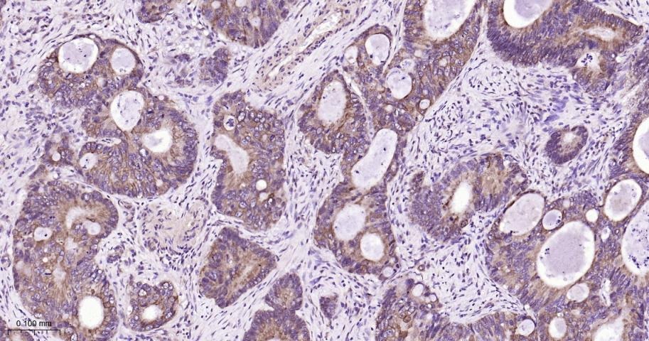 Anti-SIRT3 Polyclonal Antibody