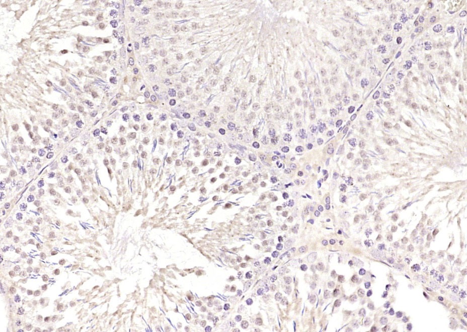 Anti-SKA3 Polyclonal Antibody