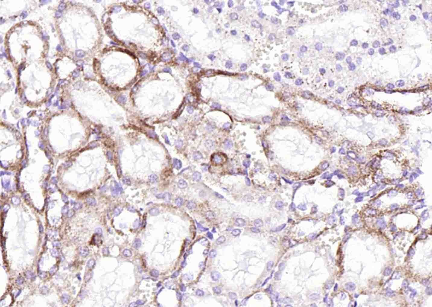 Anti-SLC39A14 Polyclonal Antibody
