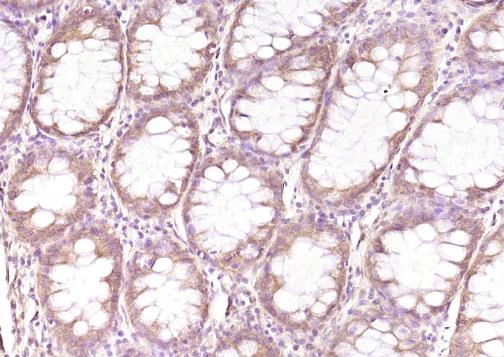 Anti-SPARC Polyclonal Antibody