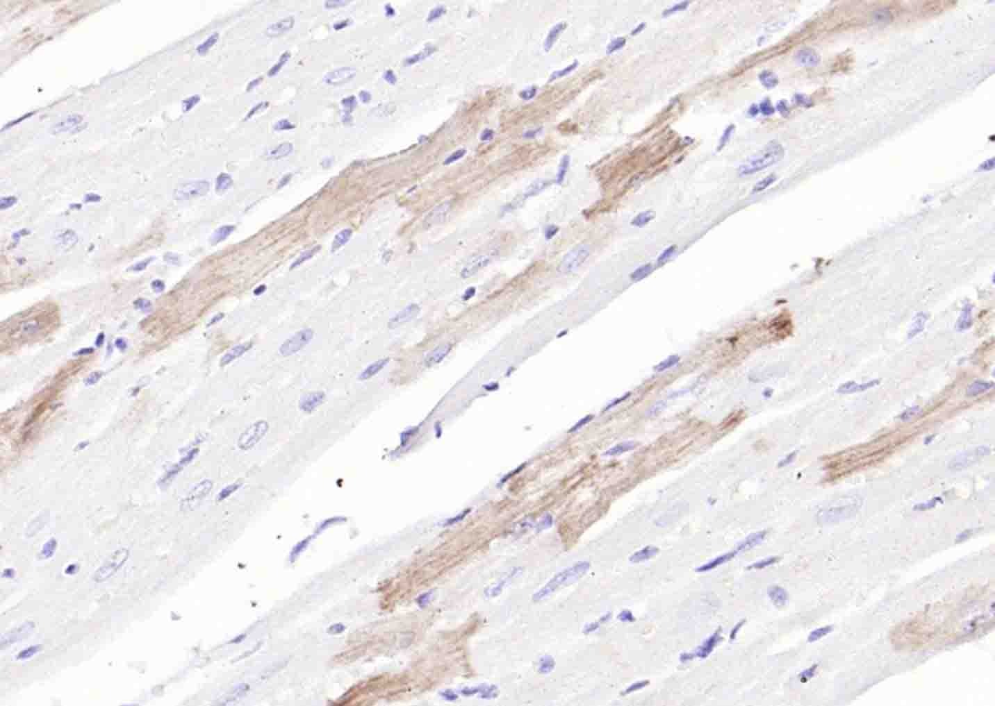Anti-SLC39A14 Polyclonal Antibody