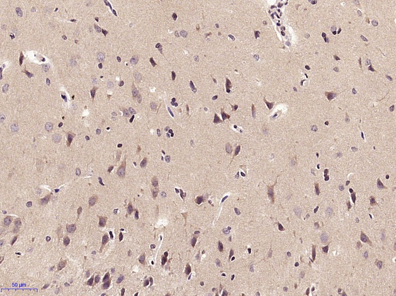 Anti-SPARCL1 Polyclonal Antibody