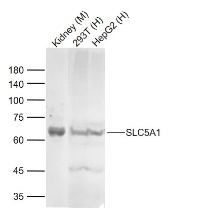 Anti-SLC5A1 Polyclonal Antibody