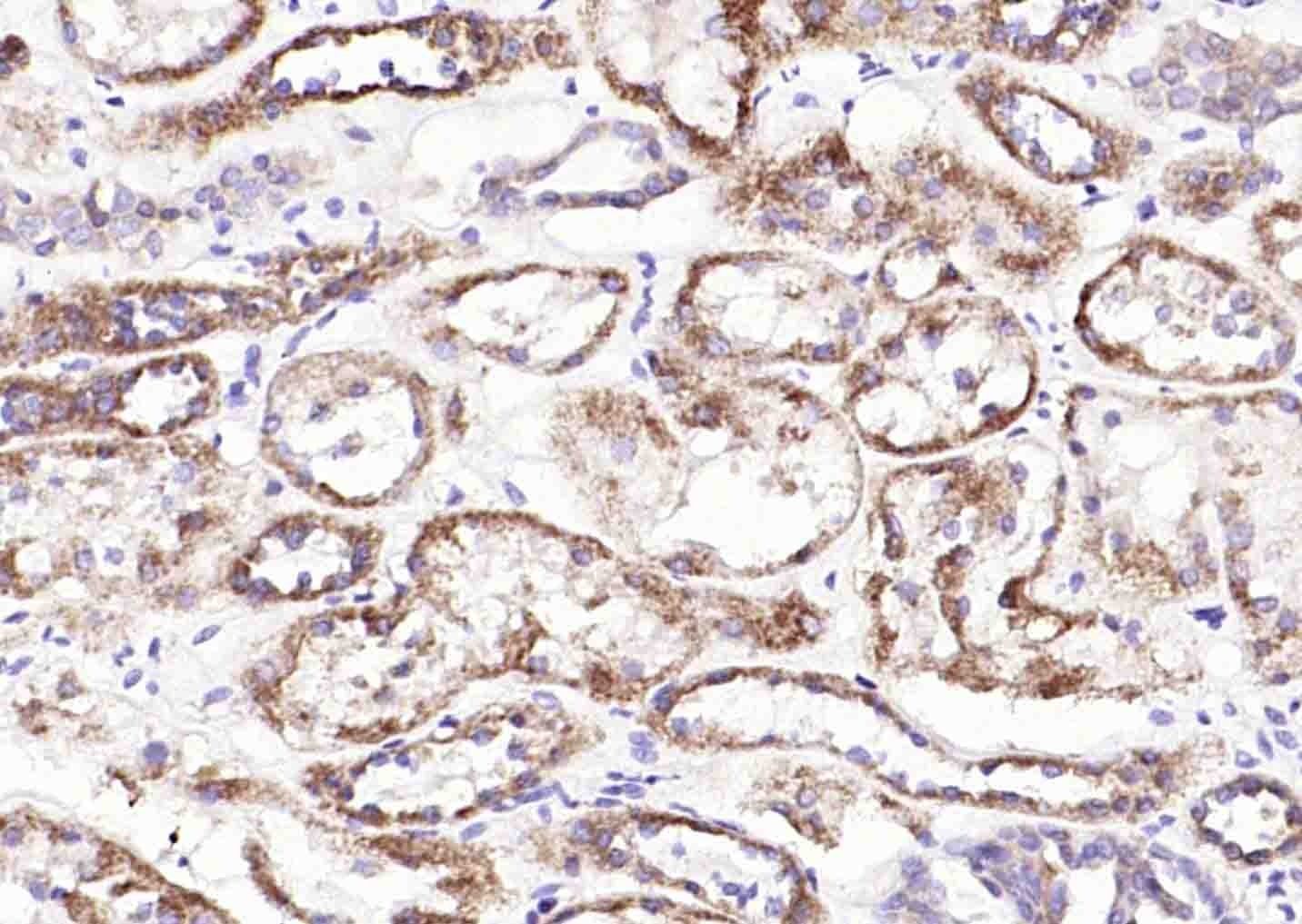 Anti-SLC39A14 Polyclonal Antibody