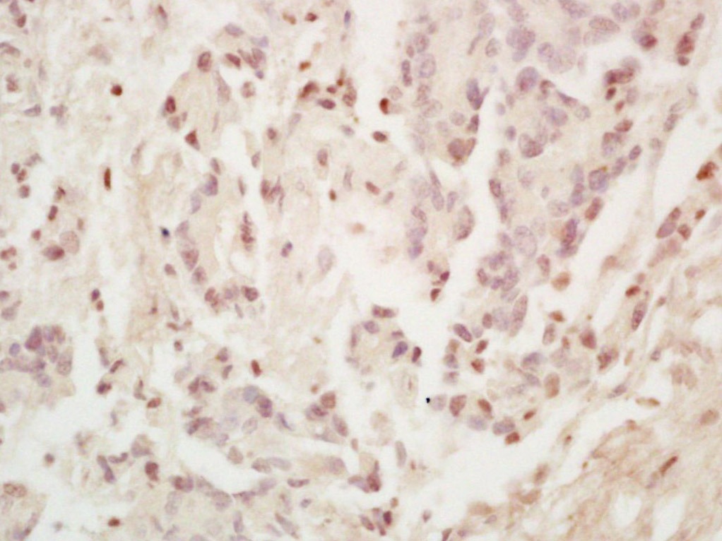 Anti-SP1 Polyclonal Antibody